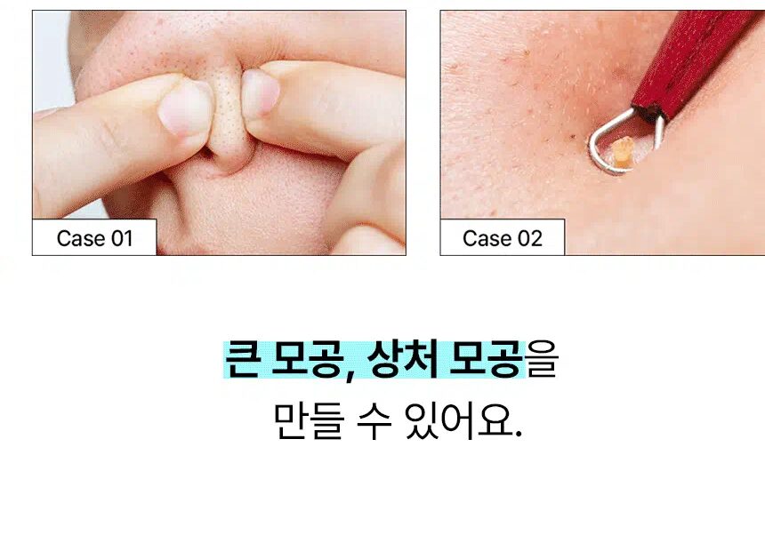 sebum_softener_key_10.gif